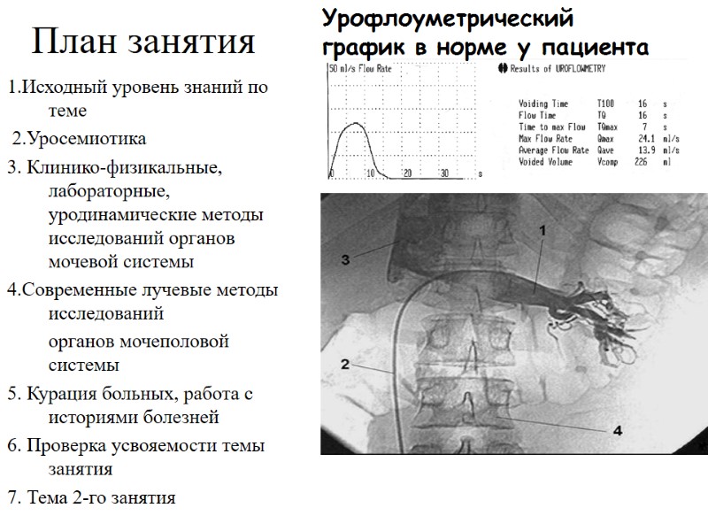 План занятия 1.Исходный уровень знаний по теме  2.Уросемиотика 3. Клинико-физикальные, лабораторные, уродинамические методы